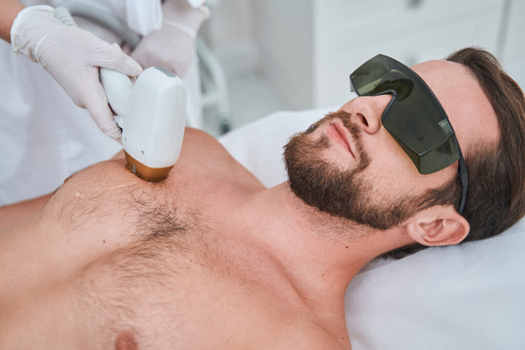 Men Laser Hair Removal at Skin House, Luton