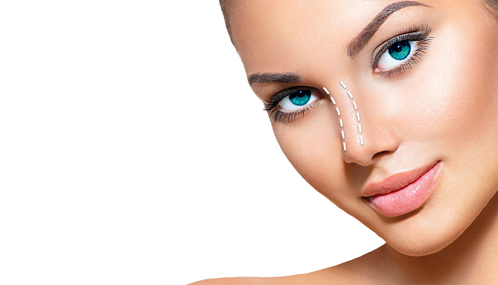 Non-surgical Rhinoplasty