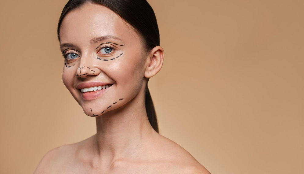 Skin Laxity